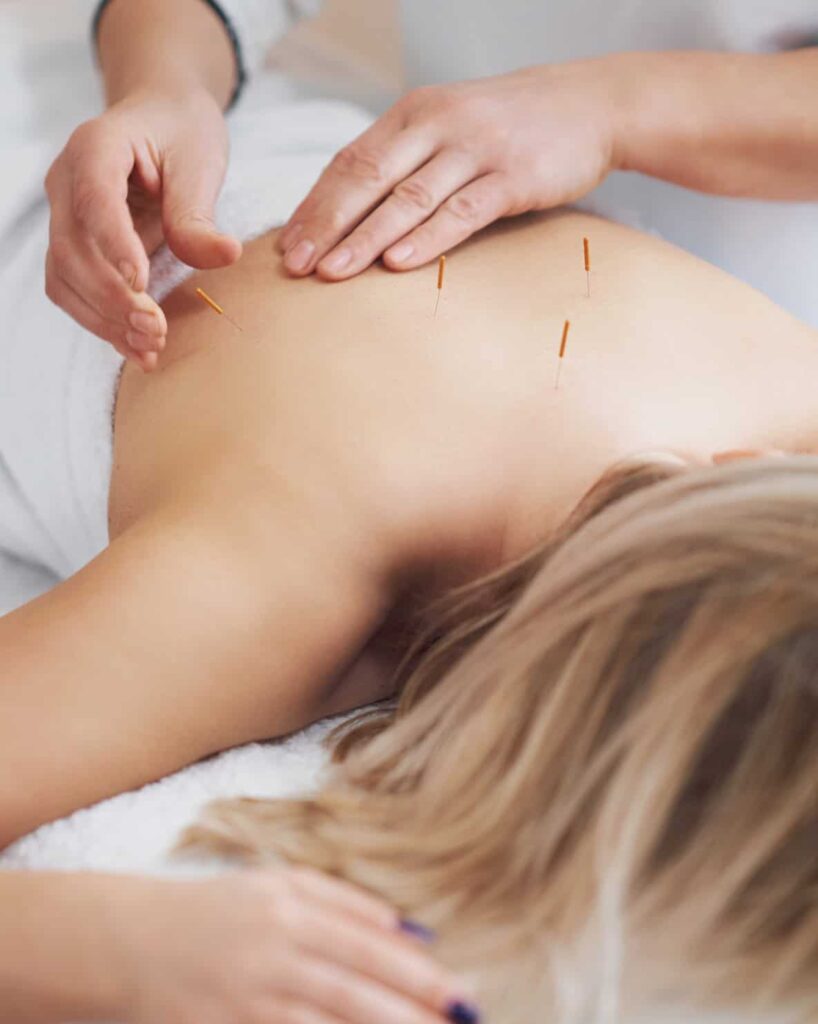 Akupunktura Środa Wielkopolska Gniezno Września